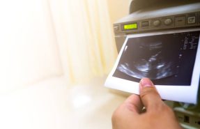 Sewa Printer DNP | Jakarta dan Jogja