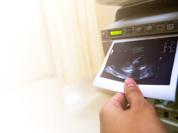 Sewa Printer DNP | Jakarta dan Jogja